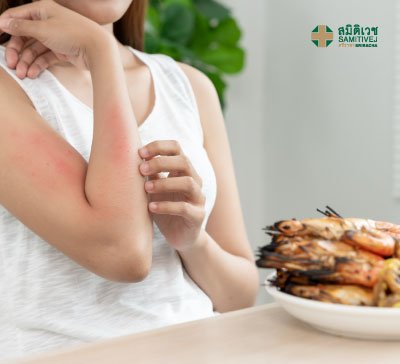 ทดสอบสารก่อภูมิแพ้ในอาหาร ทางผิวหนัง 10 จุด